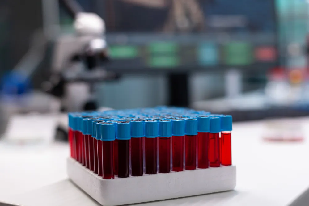 How Long Can a DNA Sample Last? Expert Preservation Tips in Los Angeles